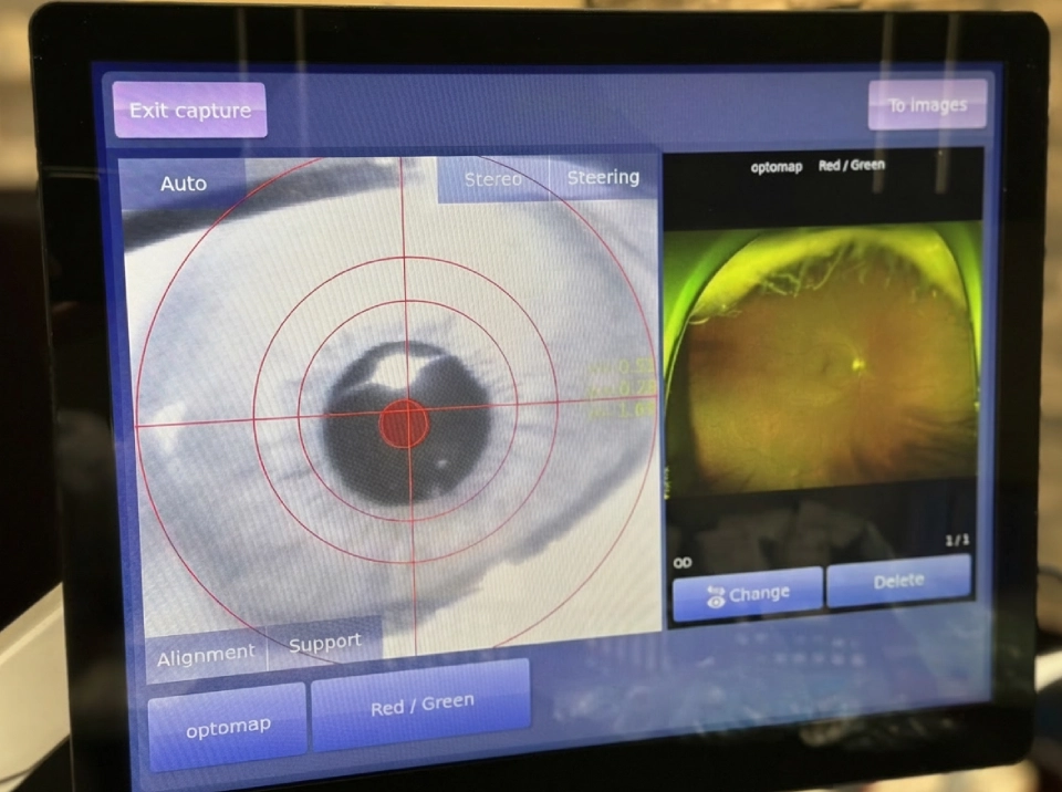 retinal imaging in pembroke pines